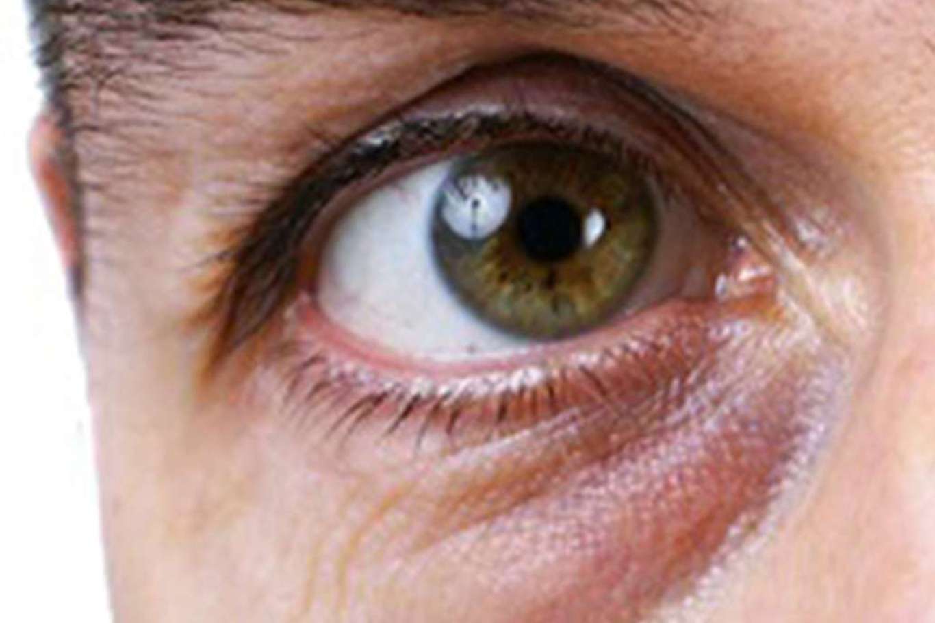 Görme kaybına neden olan hastalıklara dikkat